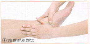 踝关节扭伤的穴位按摩疗法