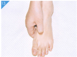 小儿中耳炎的穴位按摩疗法