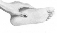 高脂血症的反射区按摩疗法