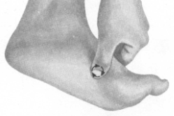 高脂血症的反射区按摩疗法