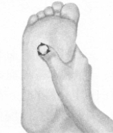 高脂血症的反射区按摩疗法