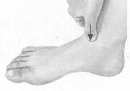 风湿病的反射区按摩疗法