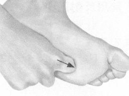 风湿病的反射区按摩疗法