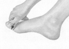 风湿病的反射区按摩疗法