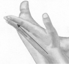 风湿病的反射区按摩疗法