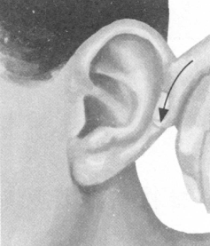 风湿病的反射区按摩疗法