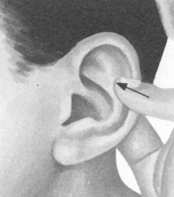 风湿病的反射区按摩疗法