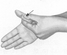 风湿病的反射区按摩疗法