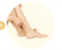 眩晕的拔罐疗法