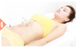 胃痉挛的拔罐疗法