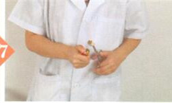 梅尼埃综合征的拔罐疗法