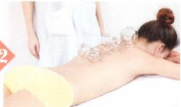 青光眼的拔罐疗法