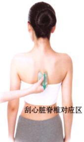 高脂血症的刮痧疗法