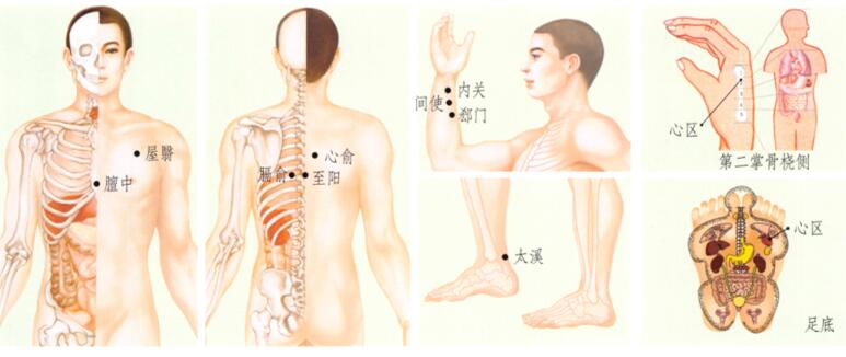 冠心病的刮痧疗法