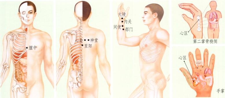 心绞痛的刮痧疗法