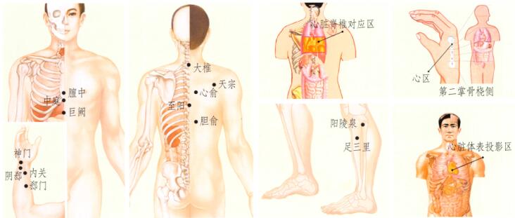 心悸的刮痧疗法