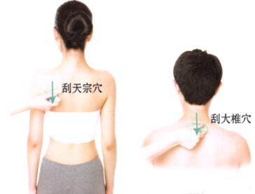 心悸的刮痧疗法