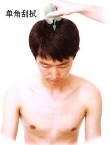 中暑的刮痧疗法