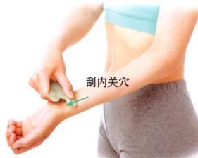 中暑的刮痧疗法