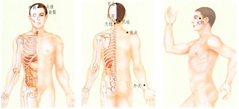 头痛的刮痧疗法
