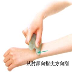 头痛的刮痧疗法