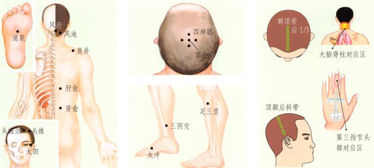 眩晕的刮痧疗法