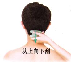 眩晕的刮痧疗法