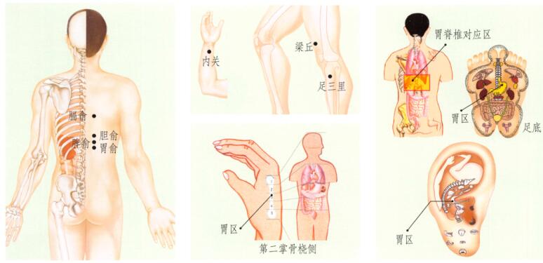 胃痉挛的刮痧疗法