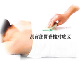 胃痉挛的刮痧疗法