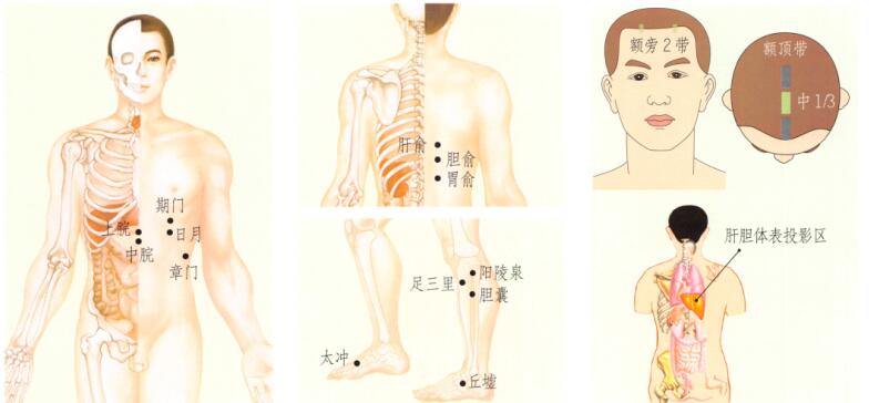 胆囊炎-胆石症的刮痧疗法