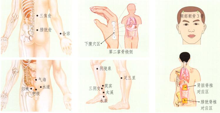 泌尿系感染的刮痧疗法