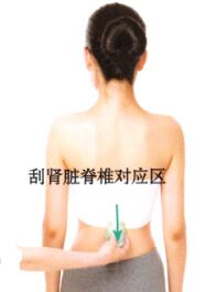泌尿系感染的刮痧疗法