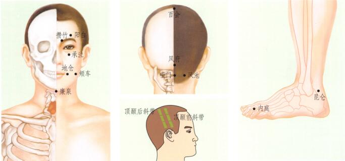 中风后遗症的刮痧疗法
