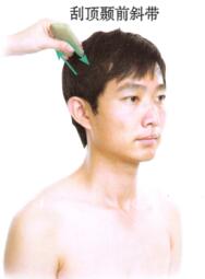 中风后遗症的刮痧疗法