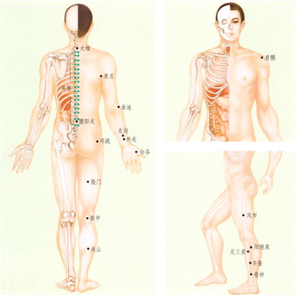 中风后遗症的刮痧疗法