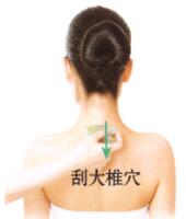 肩周炎的刮痧疗法