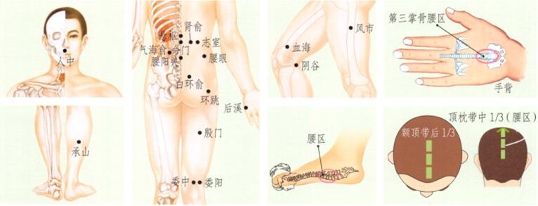腰痛的刮痧疗法
