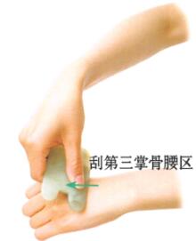 腰痛的刮痧疗法