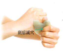腰痛的刮痧疗法