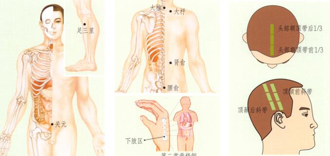 风湿性关节炎的刮痧疗法