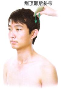 风湿性关节炎的刮痧疗法
