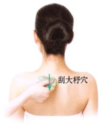风湿性关节炎的刮痧疗法