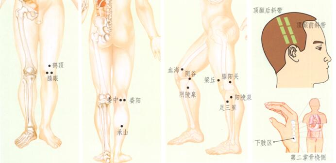 膝关节痛的刮痧疗法