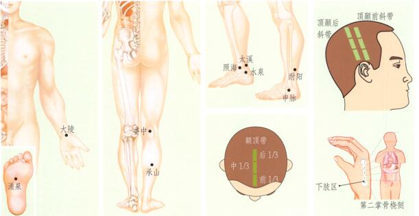 足跟痛的刮痧疗法