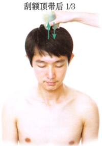 足跟痛的刮痧疗法