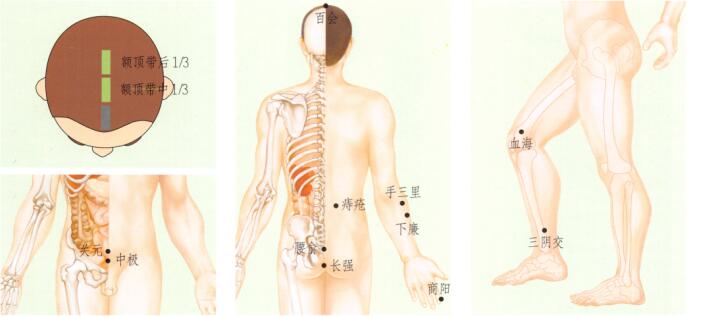 痔疮的刮痧疗法