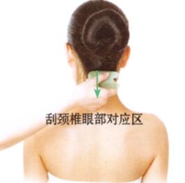 视力减退的刮痧疗法