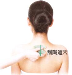 湿疹的刮痧疗法