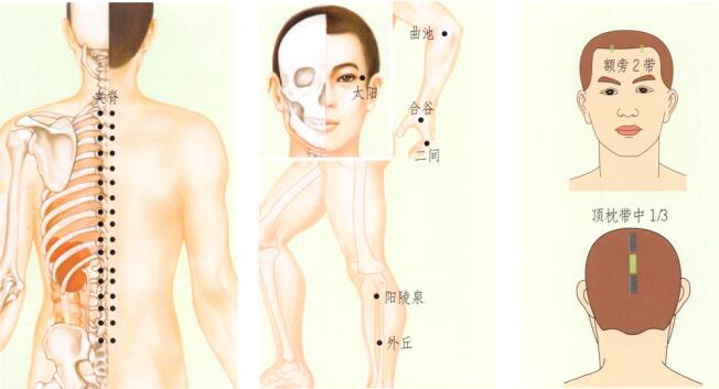 带状疱疹的刮痧疗法