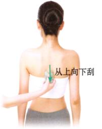 带状疱疹的刮痧疗法